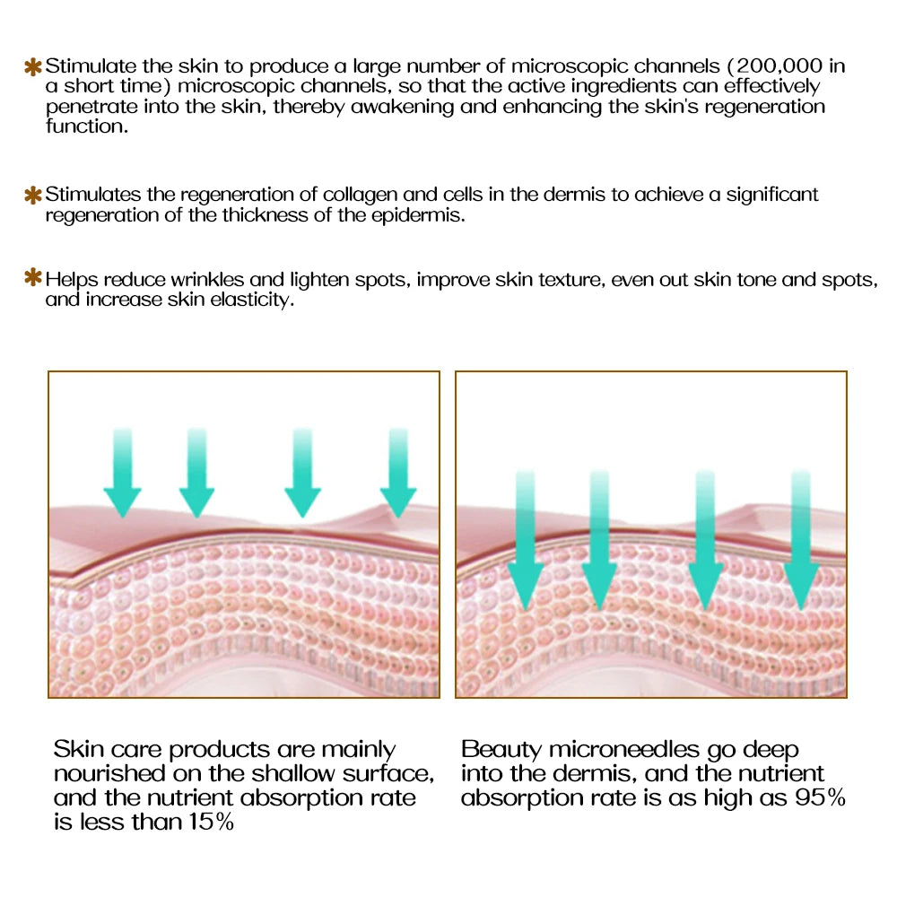 Derma Roller ZGTS 540 Needles Microneedle Roller Face Body for Home Use Microdermabrasion Face Roller Skin Care Roller